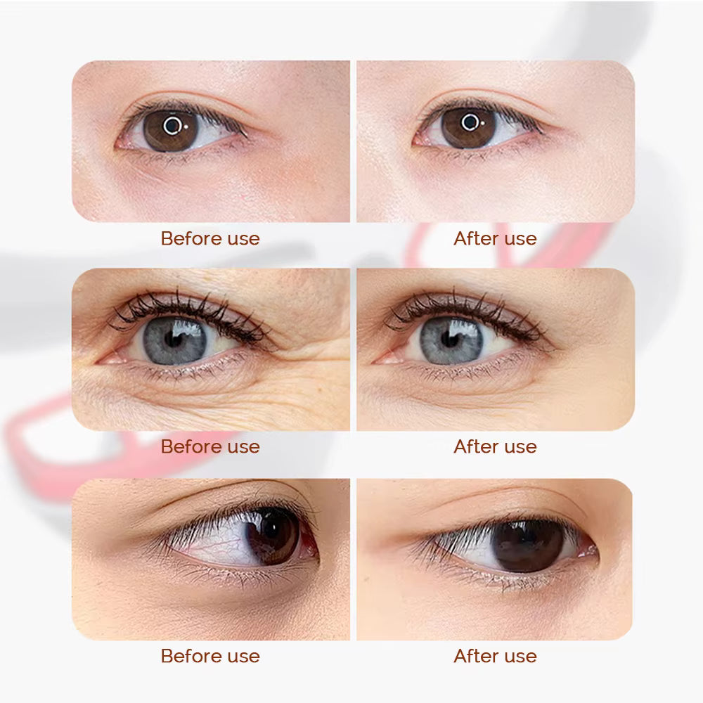 3D Wireless Eye Massager – Red Light Therapy for Dark Circles & Eye Fatigue Relief