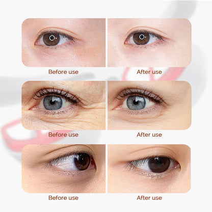 3D Wireless Eye Massager – Red Light Therapy for Dark Circles & Eye Fatigue Relief